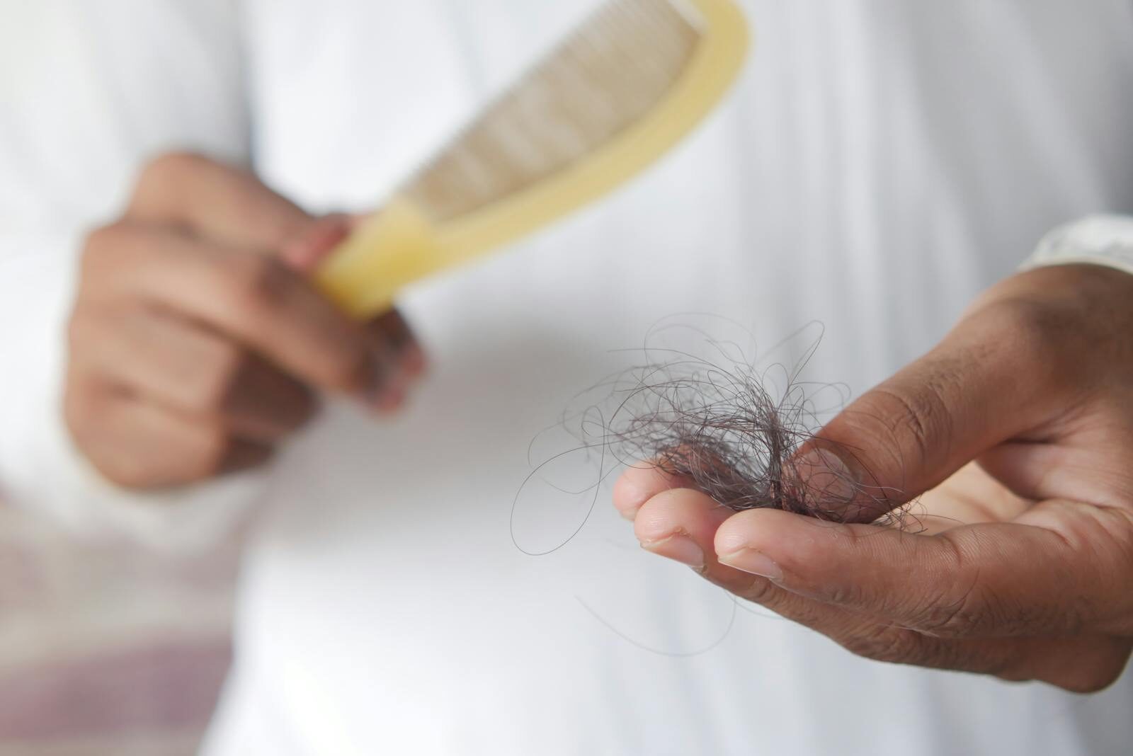 Estresse, Inflamação Sistêmica e Doenças Autoimunes: O Cenário Atual da Queda Capilar