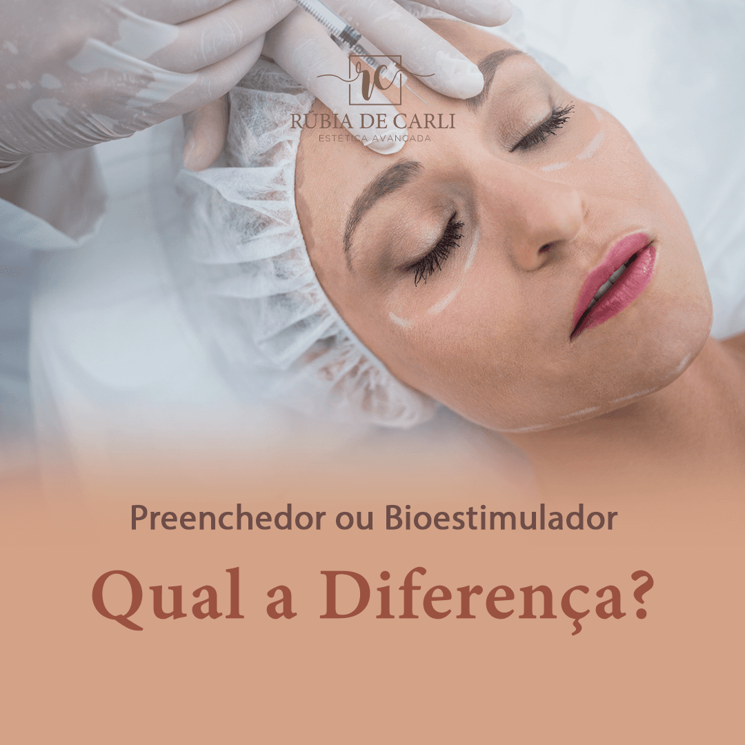 Preenchedor ou Bioestimulador, qual a diferença?