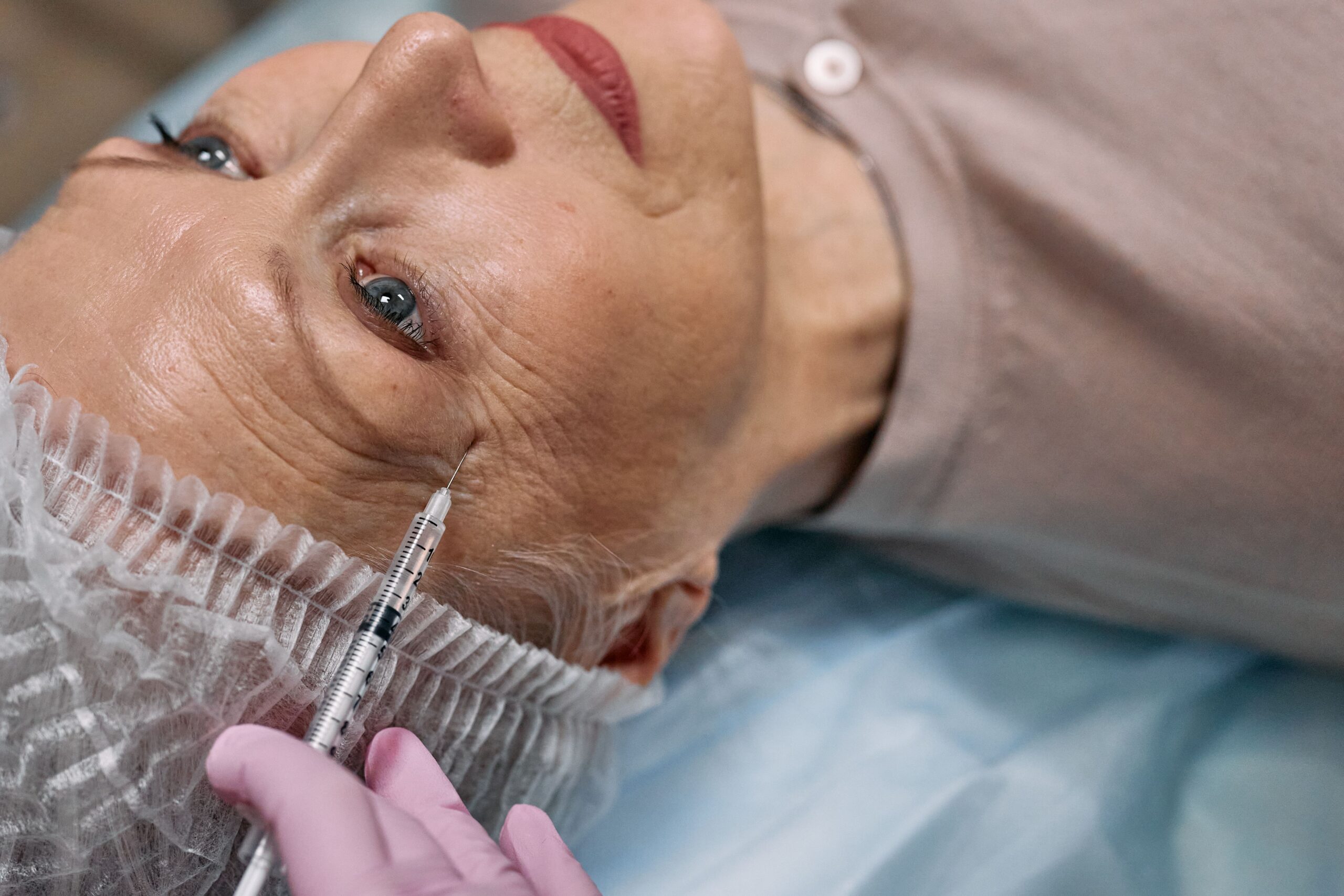 PRP + Laser CO2: Rejuvenescimento Facial Combinado