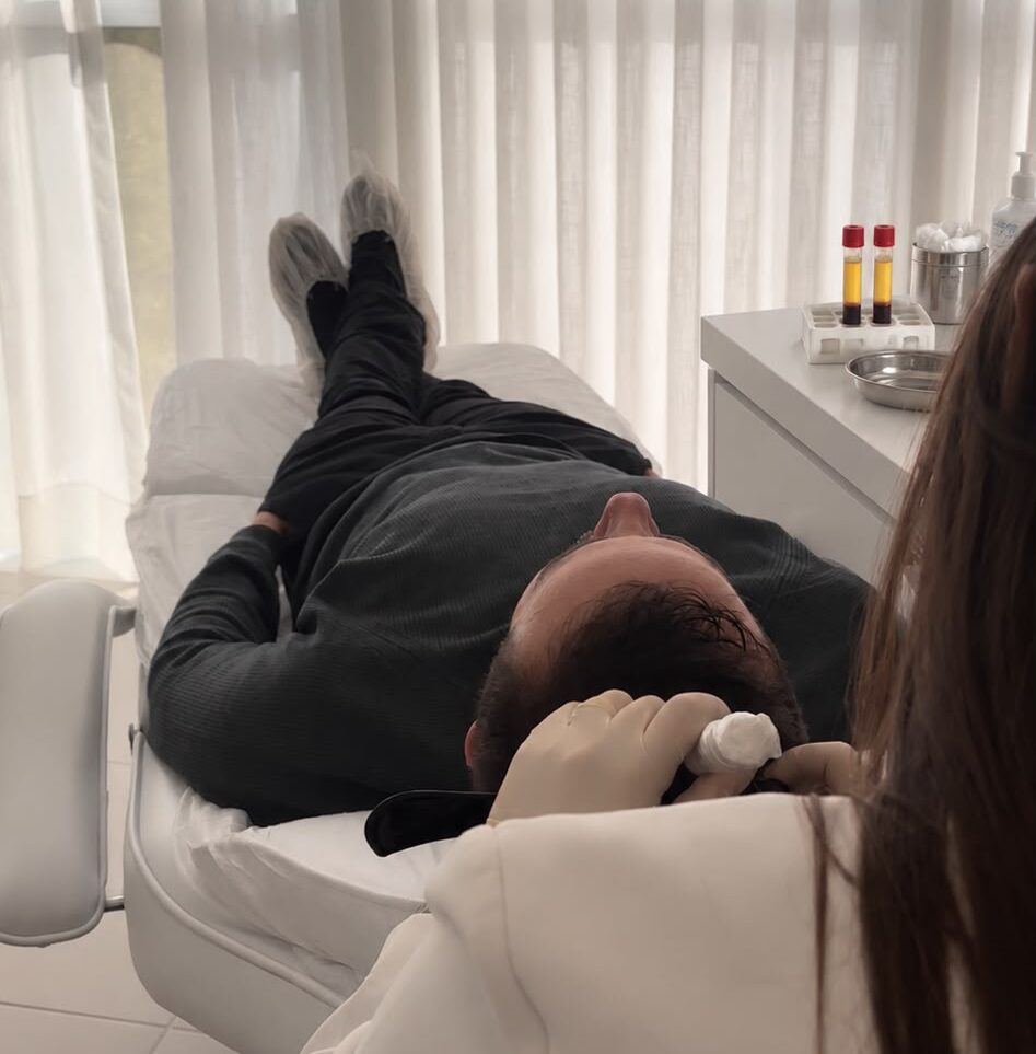 PRP para Queda de Cabelo: Funciona? Evidências e Protocolo